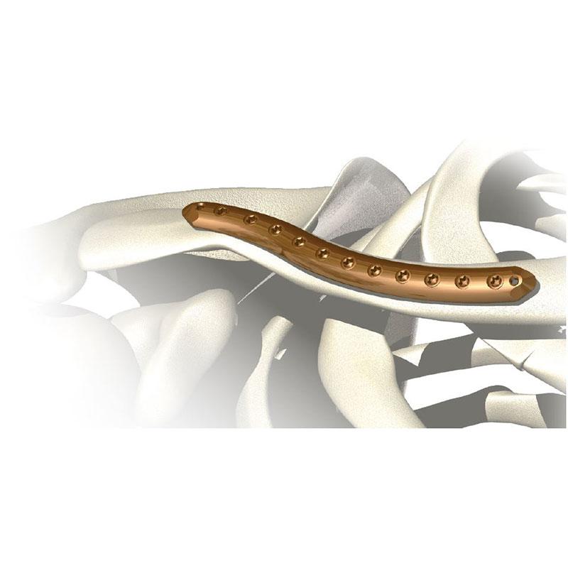 Пластина для ключиці S-подібна 5.0ChLP